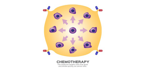 What's Chemotherapy Treatment?